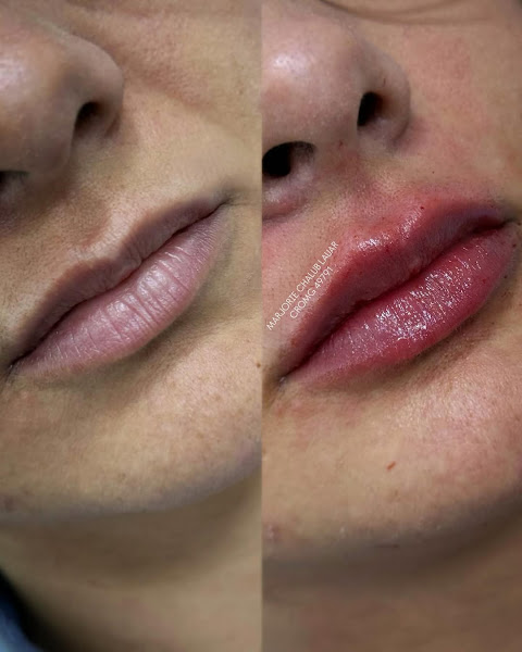 Foto 3 de Dra. Marjorie Chalub Lauar - Harmonização Facial em Belo Horizonte - MG