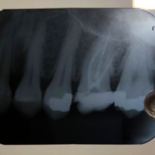 Foto 3 de Dra. Marlene Amorim (Dentista) - Endodontista e Clínica geral