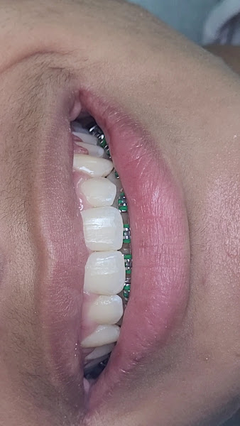 Foto 4 de Dra. Marli Mendes Odontologia Estética