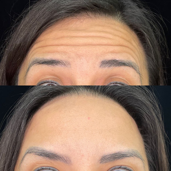 Foto de Dra. Mary Helen Harmonização Facial