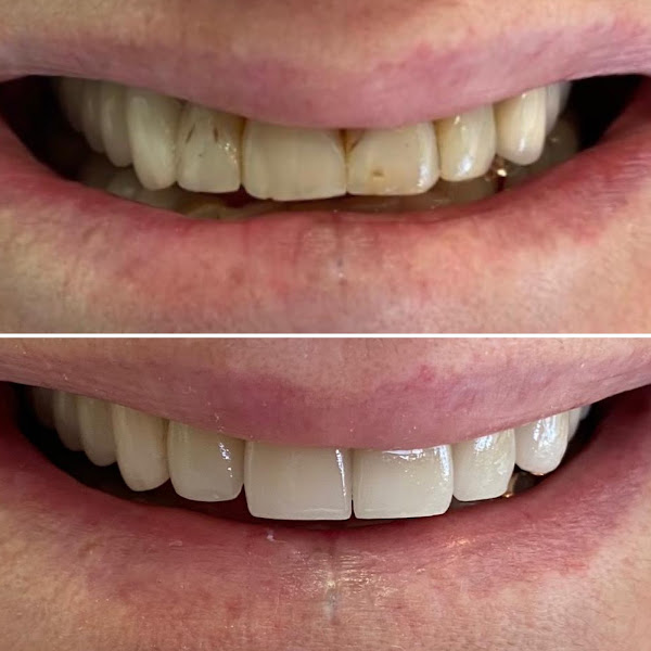 Foto 3 de Dra. Mayara Venturinelli - Cirurgiã-Dentista