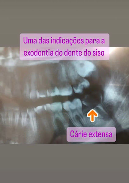 Foto 3 de Dra. Mayra Prado Cirurgiã Dentista Bucomaxilo Facial