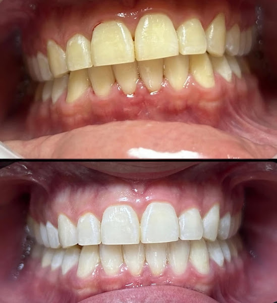 Foto 2 de Dra. Maysa Alves de carlos - dentista em Rib Preto 24h