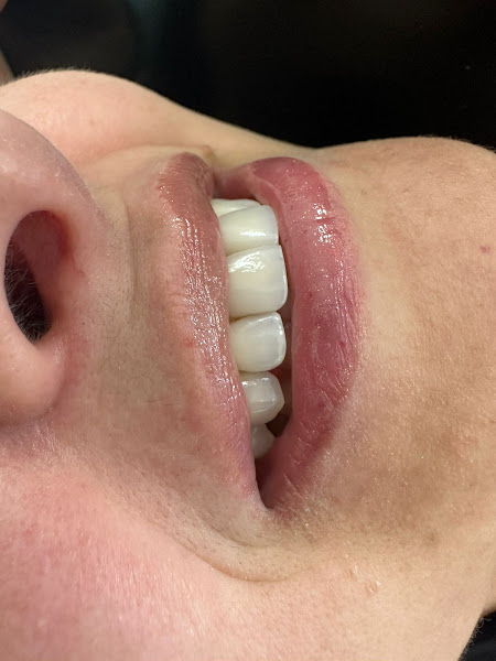 Foto 3 de Dra Meiriele Goivinho - Odontologia - Portão