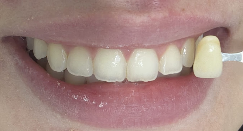 Foto 3 de Dra. Melina Miranda | Dentista