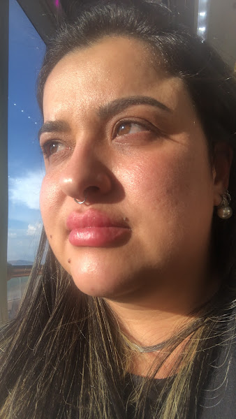 Foto 3 de Dra Melissa Luz - Especialista em Preenchimento Labial na Barra e Full Face