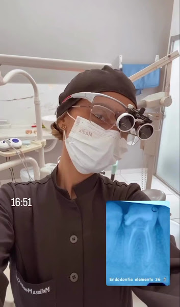 Foto 2 de Dra Melissa Mendes - Dentista em Lavras de Tratamento de Canal