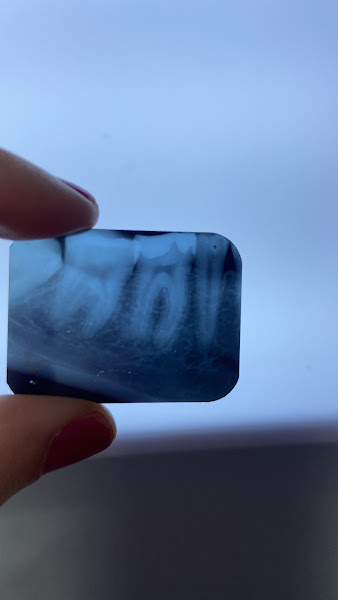 Foto 3 de Dra Melissa Mendes - Dentista em Lavras de Tratamento de Canal