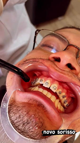 Foto 2 de Dra Melissa Nalifico | Dentista em Colombo | Aparelho ortodôntico