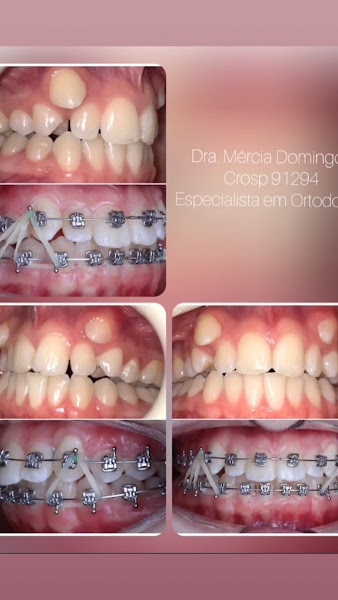 Foto 3 de Dra Mércia Odontologia e Harmonização Facial