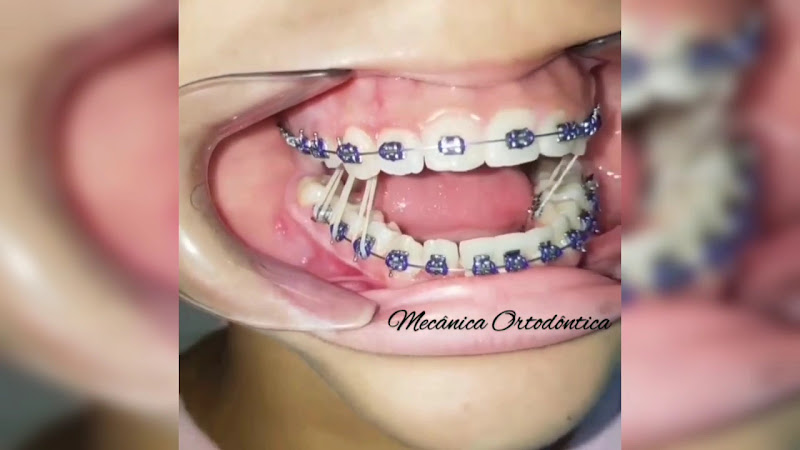 Foto 3 de Dra Mércia Odontologia e Harmonização Orofacial