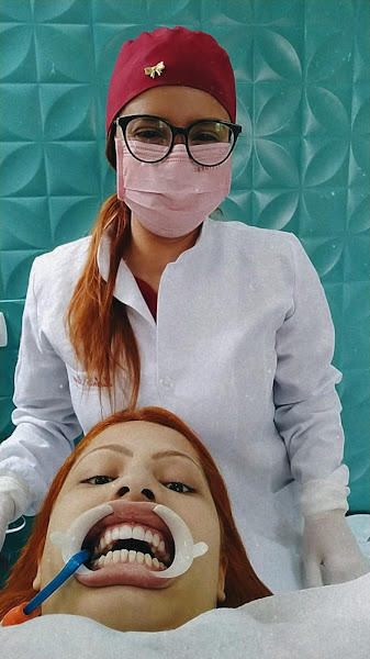 Foto 2 de Dra Michele Borges - Lentes/Facetas em Resina