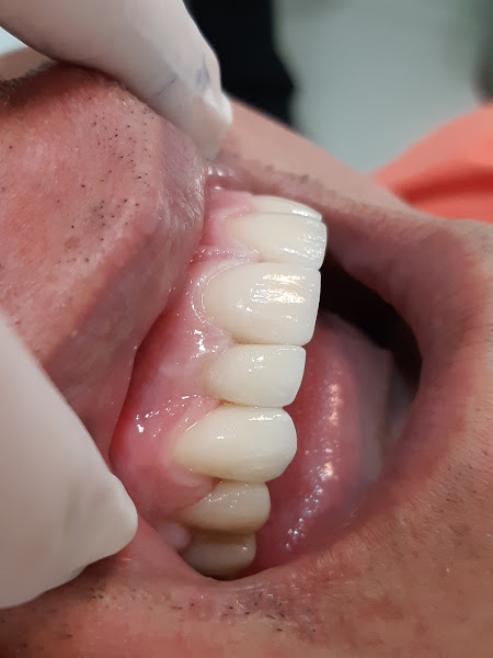 Foto 3 de Dra. Michele Brandão