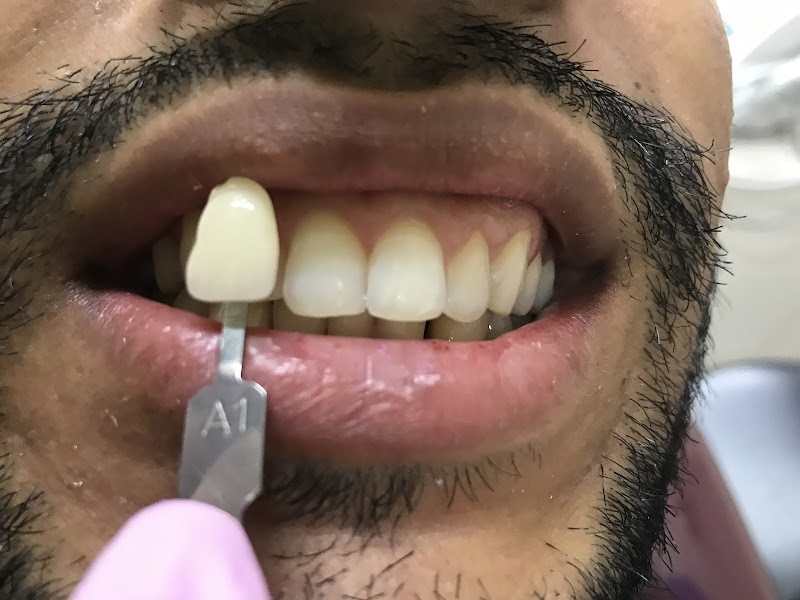 Foto 2 de Dra. Michele Lima - odontologia