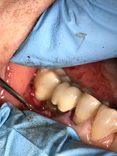 Foto 3 de Dra. Michele Lima - odontologia