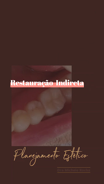 Foto 4 de Dra. Michele Rocha - Dentista - Morumbi - Vila Andrade - Panamby