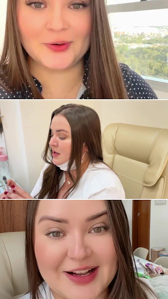 Foto 3 de Dra. Michele Yamaguchi - Especialista em Harmonização Facial