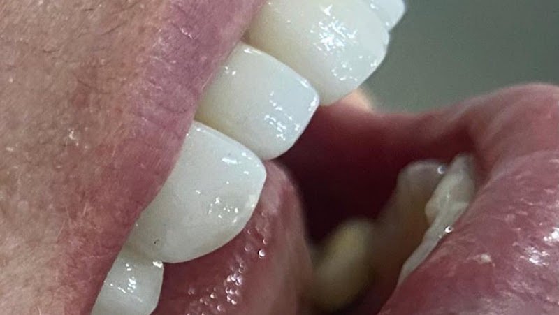 Foto 2 de Dra Michella - Dentista Munhoz Junior