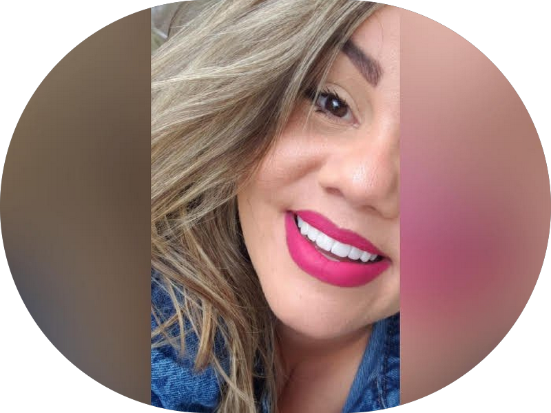 Foto 6 de Dra. Michelle Cavalcante | Lentes de Contato Dental | Implante Dentário | Dentista em Maceió