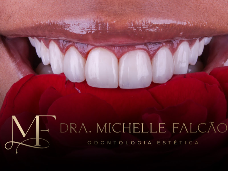 Foto de Dra. Michelle Falcão - Especialista em Lentes de Resina Composta e Porcelana