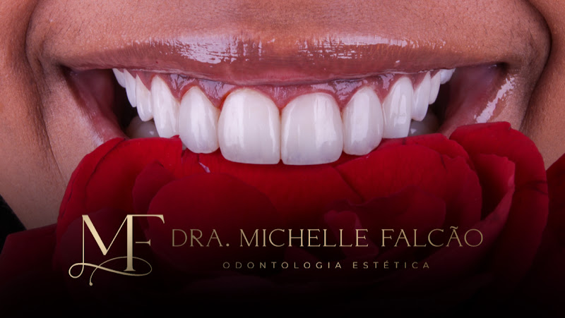Foto 2 de Dra. Michelle Falcão - Especialista em Lentes de Resina Composta e Porcelana