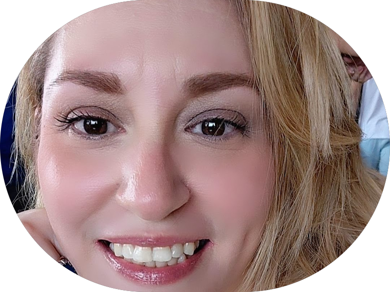 Foto 6 de Dra. Michelle Lima - Invisalign Doctor, Ortodontia, Aparelhos Invisíveis, Restaurações Estéticas, Clareamento