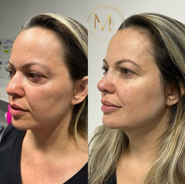 Foto 2 de Dra. Michelle Lisboa - Harmonização Facial || Manaus