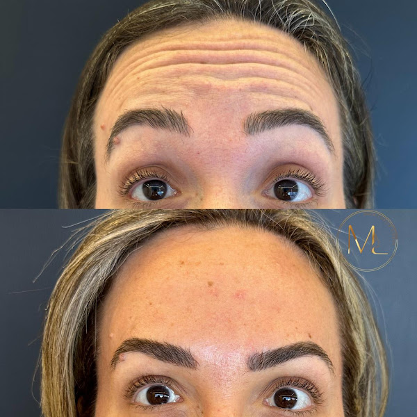 Foto 3 de Dra. Michelle Lisboa - Harmonização Facial || Manaus