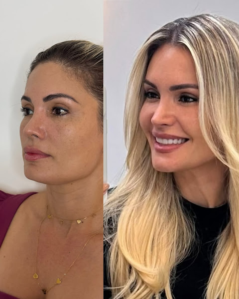 Foto 2 de Dra. Michelline Godeiro | Harmonização Facial em Recife