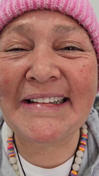 Foto 3 de Dra. Milena Conti CRO: 79961 - Clínica Odontológica | Implantodontia | Reabilitação Oral | Carga Imediata | Lentes de Contato