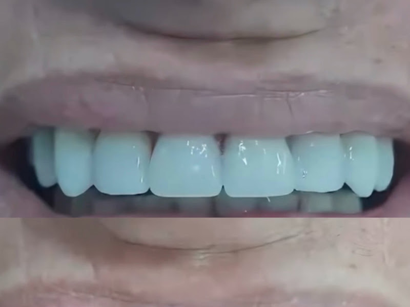Foto 3 de Dra. Milena Dias - Invisalign Doctor