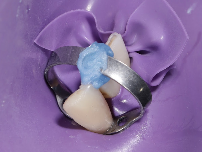 Foto 2 de Dra. Milena Gomes - Odontologia Estética