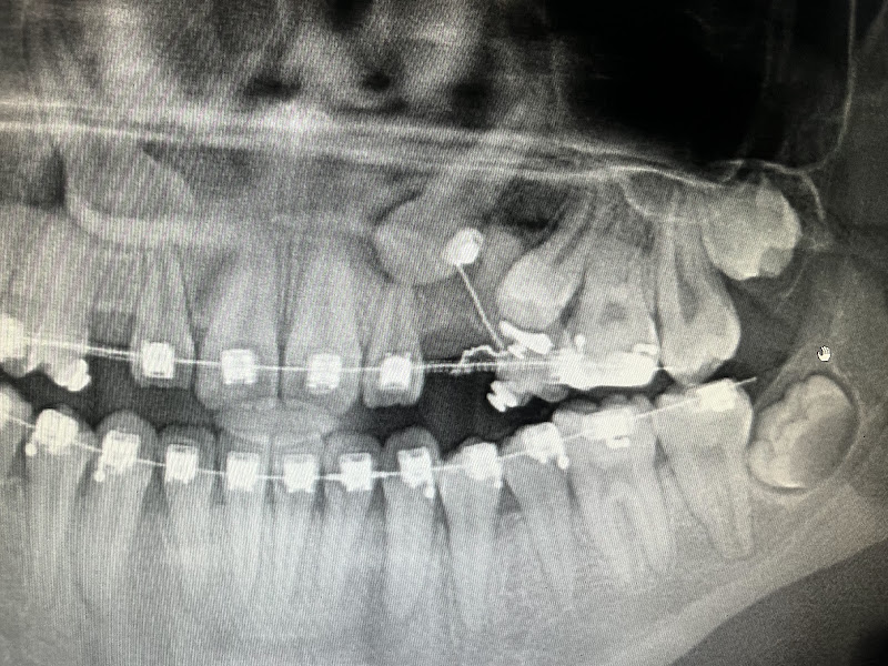 Foto 2 de Dra. Milena Mota - Cirurgia Bucomaxilofacial/ DTM e Dor Orofaciais/Harmonização Orofacial/Invisalign
