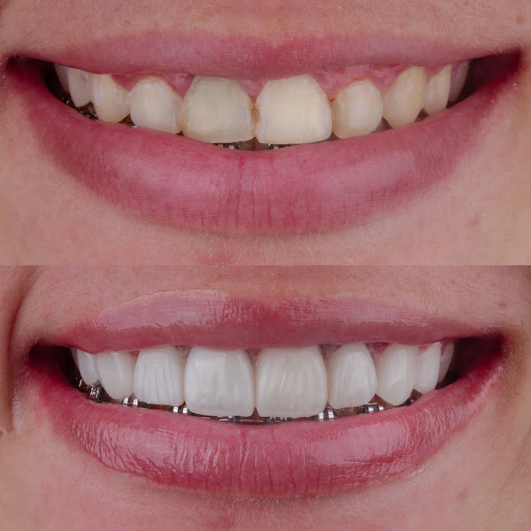 Foto 3 de Dra. Milena Santos - Dentista em Teresina-Pi e São Roberto-Ma