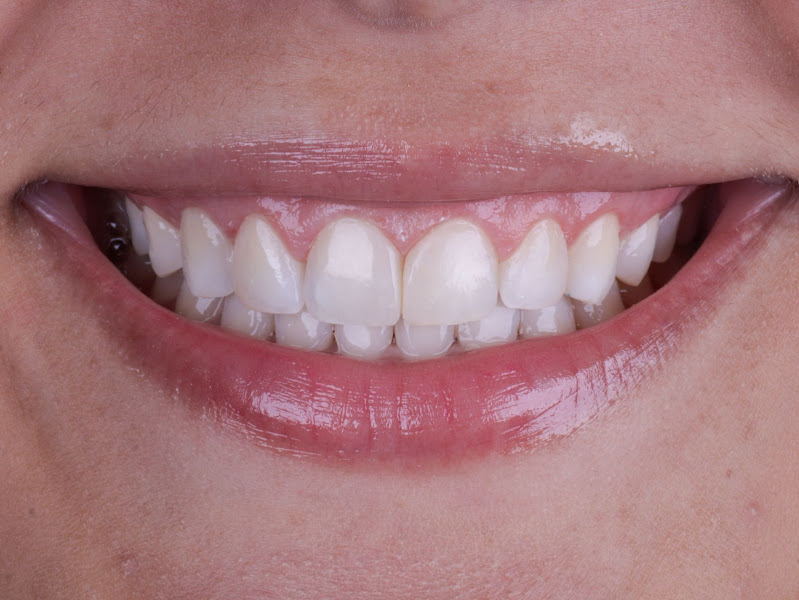 Foto 3 de Dra. Mirela Gomes - Dentista Especialista em Lentes de Resina na Vila Olímpia