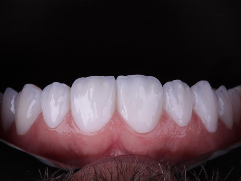 Foto 7 de Dra. Mirela Gomes - Dentista Especialista em Lentes de Resina na Vila Olímpia