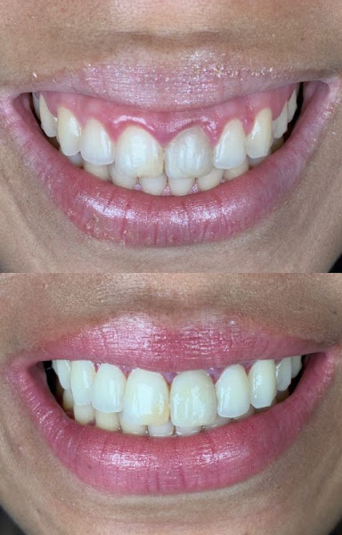 Foto 3 de Dra Mirena Hauss - Periodontista em BH