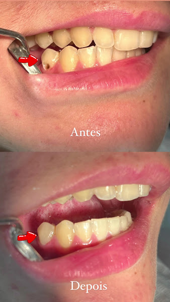 Foto 3 de Dra Mohrana Santana & Dr Wellington - Dentista - clínica odontológica; Cruzeiro do sul