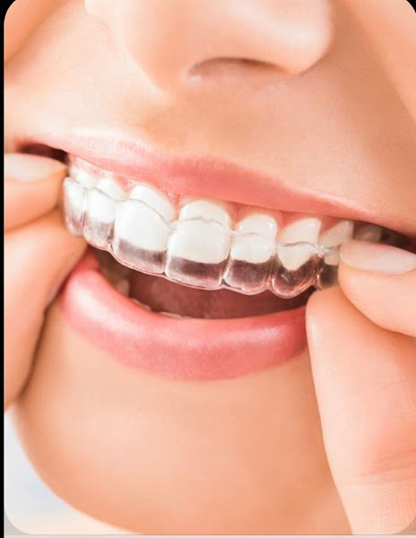 Foto 4 de Dra. Mônica Casimiro Ortodontia Alinhadores Harmonização Facial