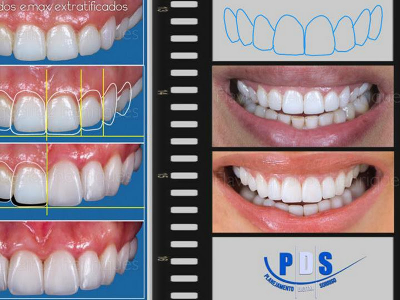 Foto de Dra.Mônica de Sá Moreira-Especialista em distúrbios da ATM