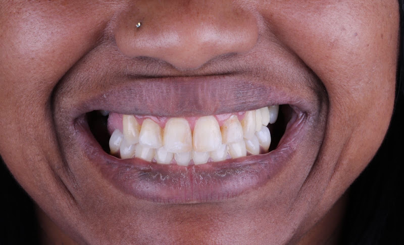 Foto 2 de Dra Mônica Irma - Dentista