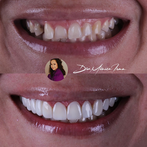 Foto 3 de Dra Mônica Irma - Dentista
