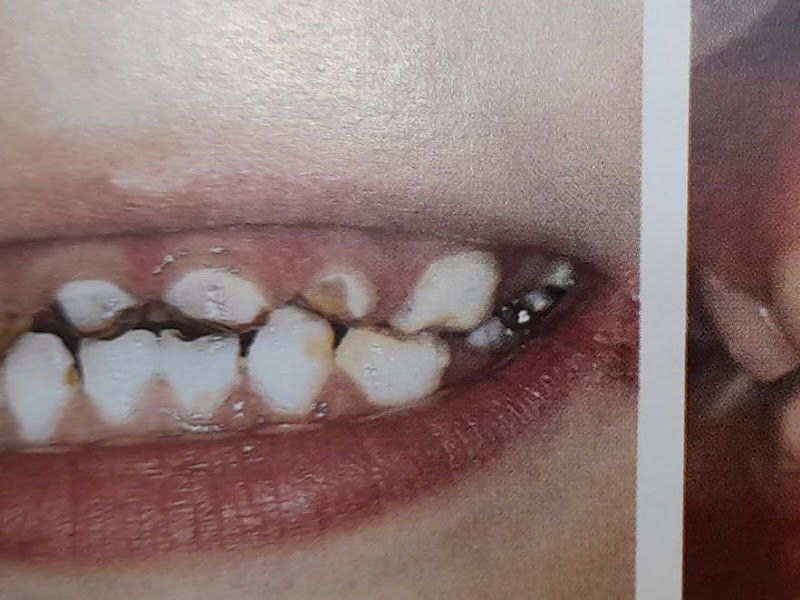 Foto de Dra. Mônica Moreira-Especialista em distúrbios da ATM , Odontopediatria,harmonização facial.