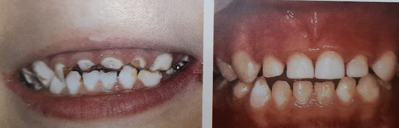 Foto 2 de Dra. Mônica Moreira-Especialista em distúrbios da ATM , Odontopediatria,harmonização facial.