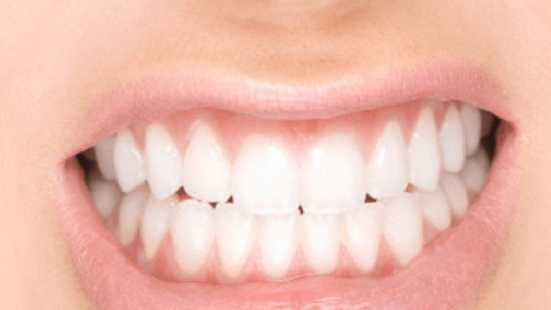 Foto 3 de Dra. Mônica Moreira-Especialista em distúrbios da ATM , Odontopediatria,harmonização facial.