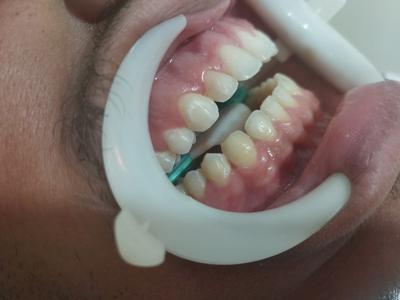 Foto 7 de Dra Monique Ferreira - Consultório Odontológico