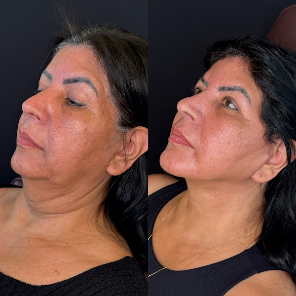 Foto 3 de Dra Monique Frauzino | Instituto Frauzino - Harmonização Facial e Odontologia