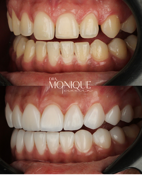 Foto 2 de Dra Monique Teixeira - Saúde e estética odontológica
