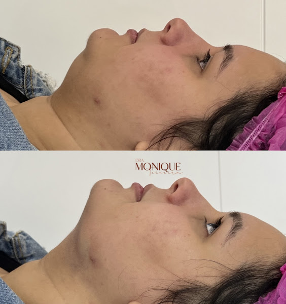 Foto 3 de Dra Monique Teixeira - Saúde e estética odontológica