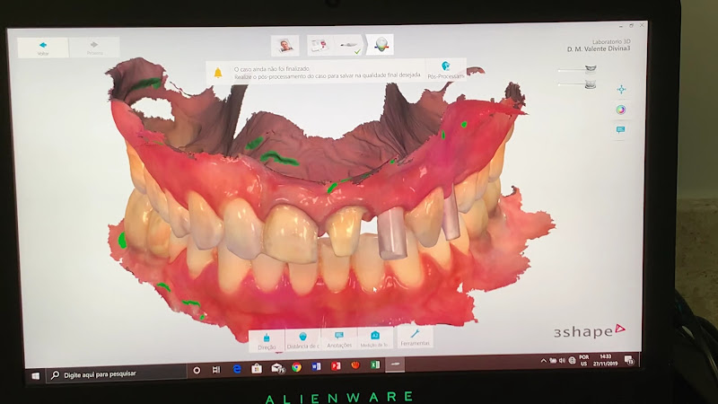 Foto 3 de Dra Monique Valente - Reabilitação Oral e Odontologia Estética